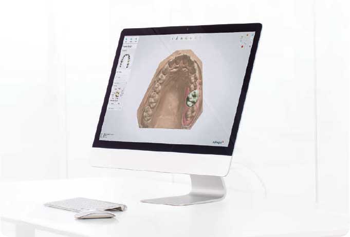 Фото ПО для стоматологии Dental System Full Contour 1 рабочее место_1